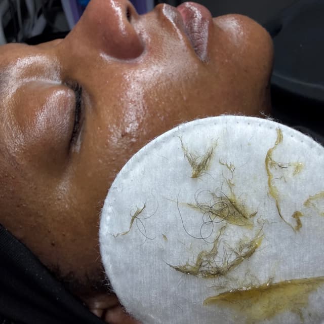 Radiant Renewal Package $350 at Radiant Eyes & Aesthetics in Petal, MS